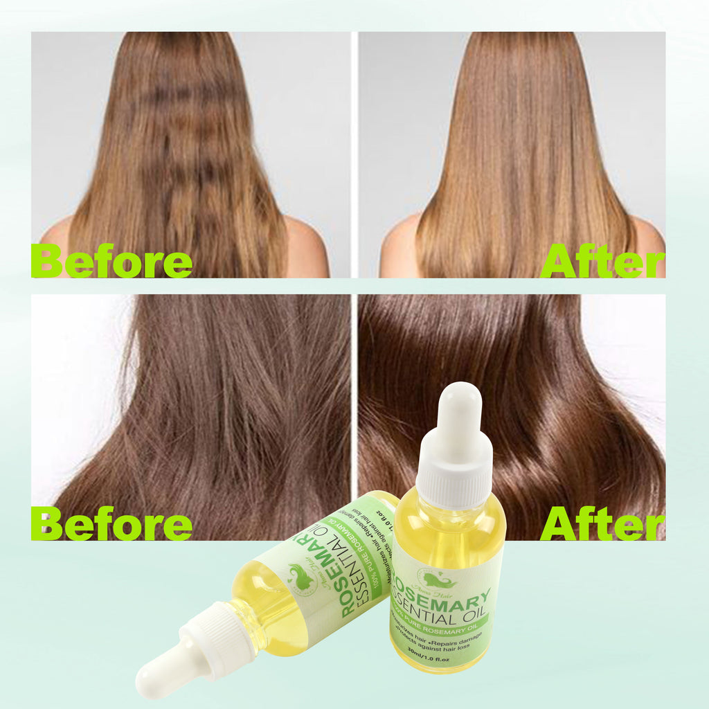 Manufacturer Supplier Wholesale Bulk Price 30ml Organic Hair Growth Oil 100% Pure Natural Rosemary Essential Oil